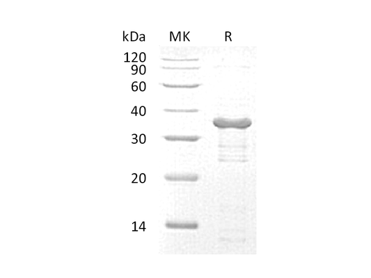 Recombinant Human UBE2R2 (N-6His)