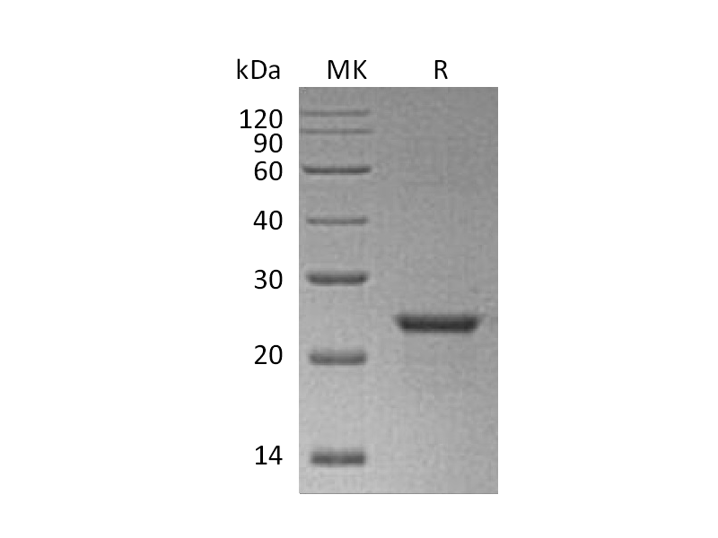 Recombinant Human NEDD8 (N-6His-SUMO)