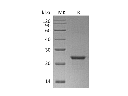 Recombinant Human NEDD8 (N-6His-SUMO)