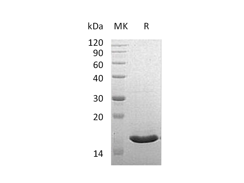 Recombinant Human VAMPB (C-6His)