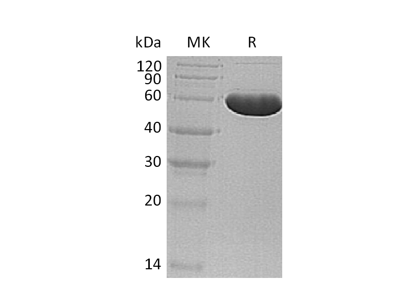 Recombinant Human WARS (N-6His)