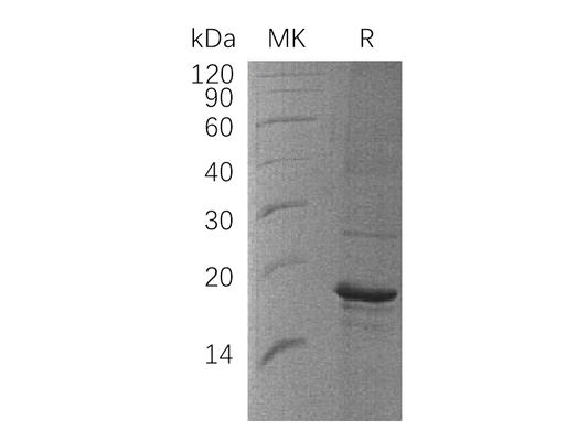 Recombinant Human ZBP1 (C-6His)