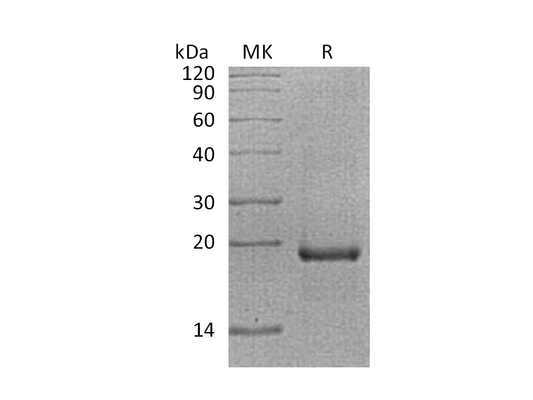 Recombinant Human EGR1 (N-6His)