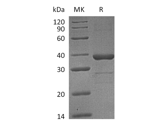 Recombinant Human ZWINT (N-6His)