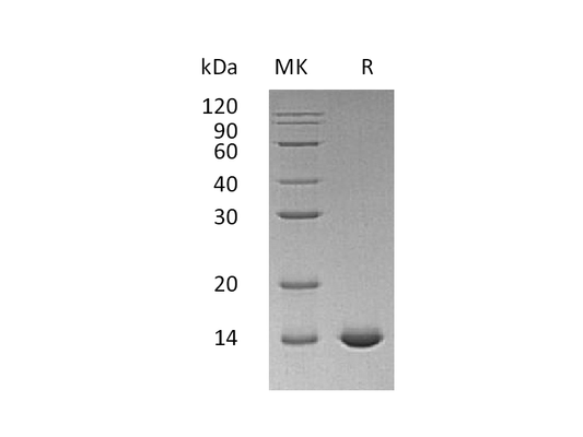 Recombinant Human IL-2 (aldesleukin)