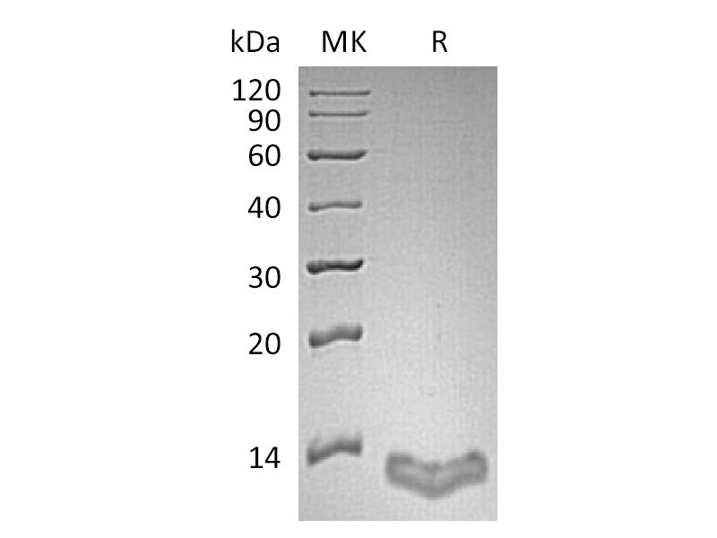 Recombinant Human S100A16