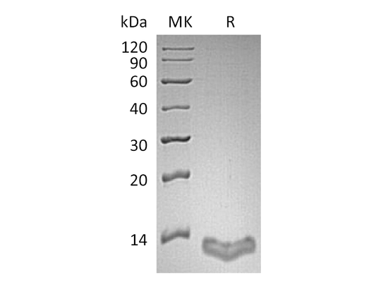 Recombinant Human S100A16