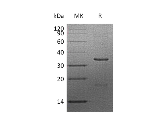 Recombinant Human CCND2 (N-6His)