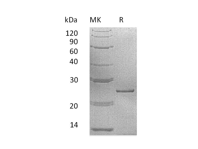 Recombinant Human PRL