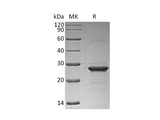 Recombinant Human OSM (N-6His)