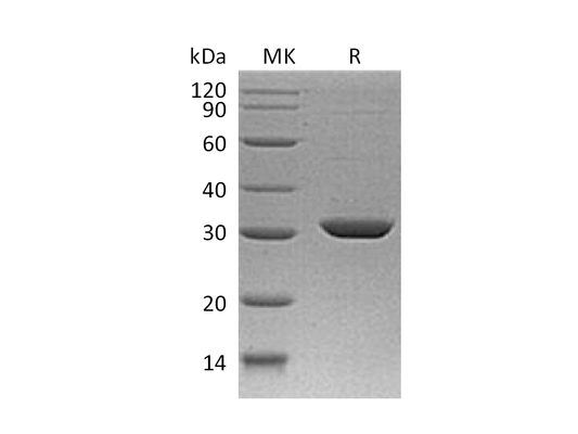 Recombinant Human Stratifin