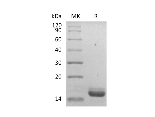 Recombinant Human IL-36RA