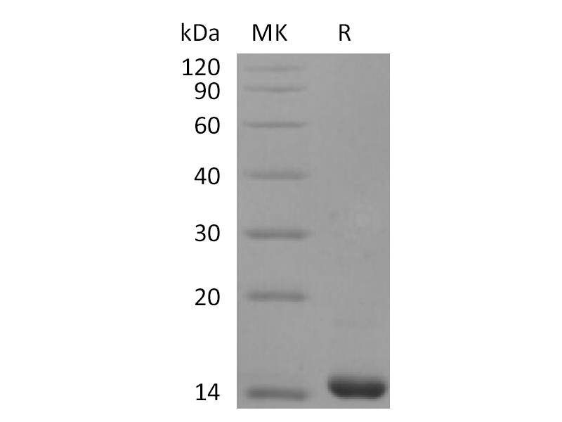 Recombinant Human FGF-4 (136AA)