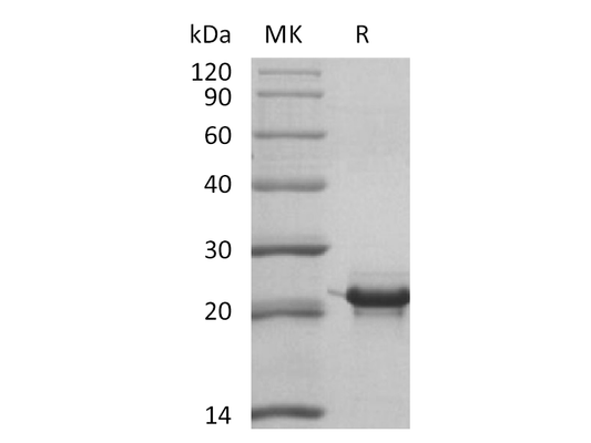 Recombinant Human KRAS4B (N-6His)