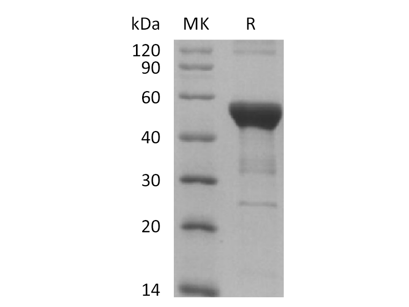 Recombinant Human NFKB1 (N-6His)