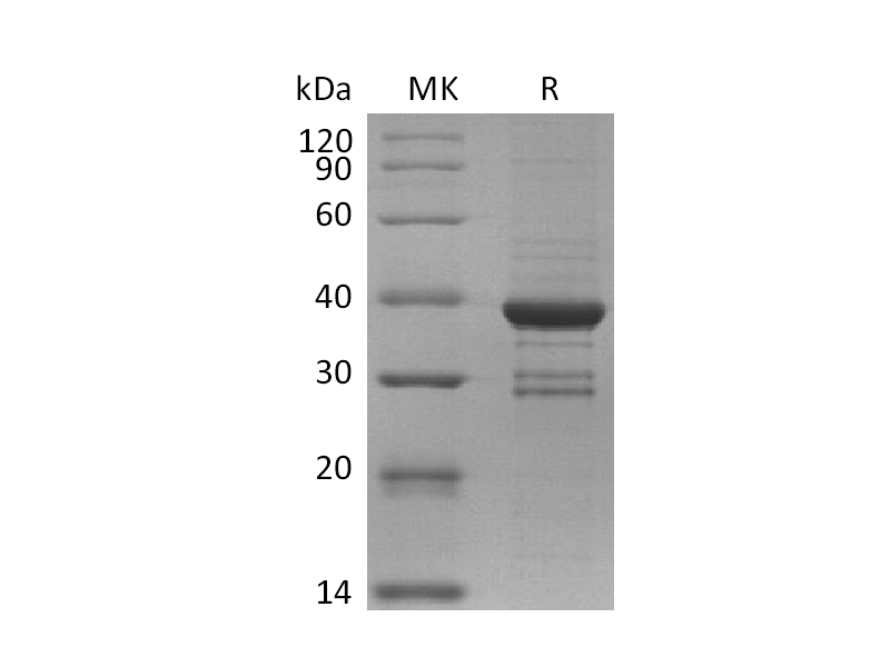 Recombinant Human MKI67 (N-GST)
