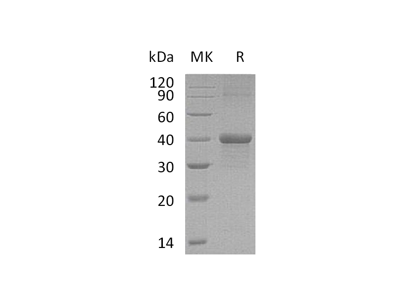 Recombinant Mouse Carbonic Anhydrase 14 (N-6His)