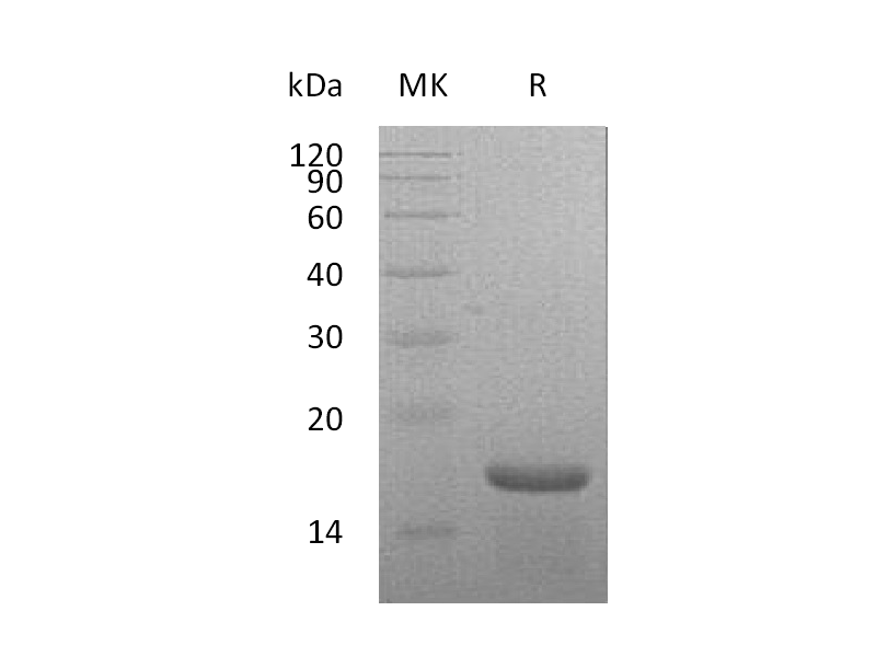 Recombinant Mouse IL-21 (N-6His)