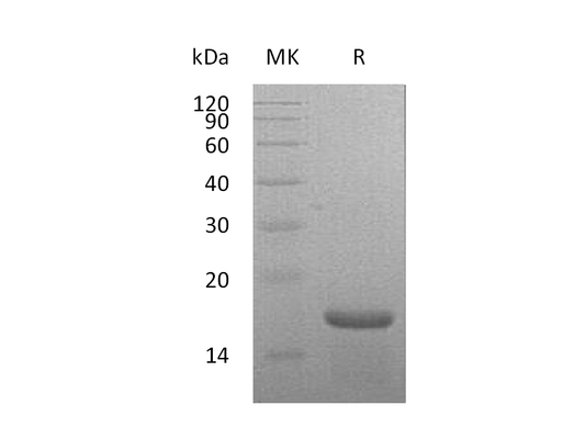 Recombinant Mouse IL-21 (N-6His)