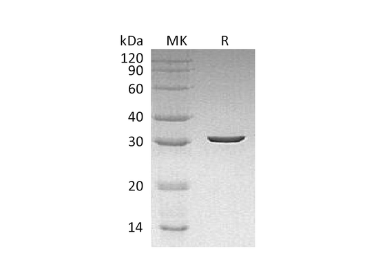 Recombinant Dechloromonas aromatica Cld (N-6His)