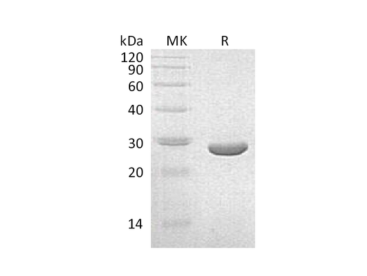 Recombinant K. pneumoniae NEO