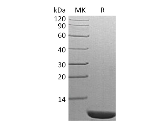 Recombinant S. cerevisiae TIM14
