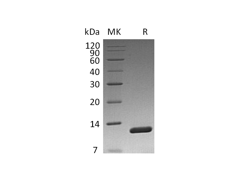 Recombinant Vibriocholerae Toxin B