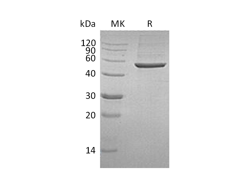 Recombinant Human 6PGD (C-6His)