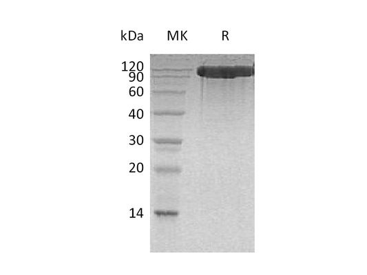 Recombinant Human ACE-2 (C-6His)