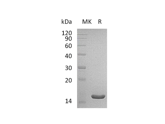 Recombinant Human ACOT13 (C-6His)