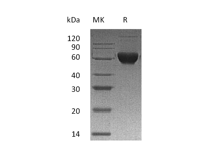 Recombinant Human ACVR2B (C-Fc-6His)