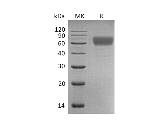 Recombinant Human AMIGO2 (C-6His)