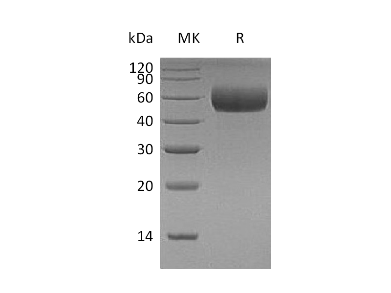 Recombinant Human ApoH (C-6His)