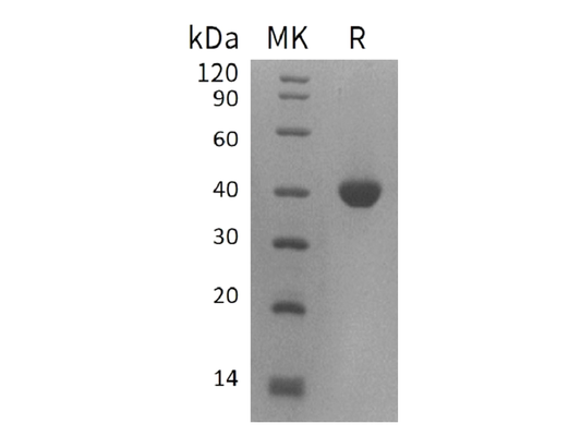 Recombinant Human B4GALT4 (C-6His)