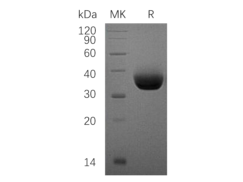 Recombinant Human PD-L1 (C-6His)