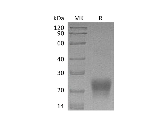 Recombinant Human BST2 (C-6His)