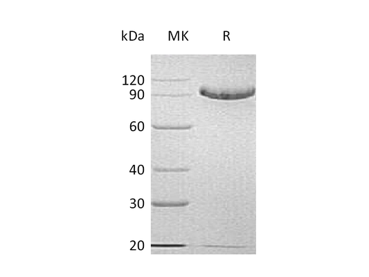 Recombinant Human C1q R1 (C-6His)