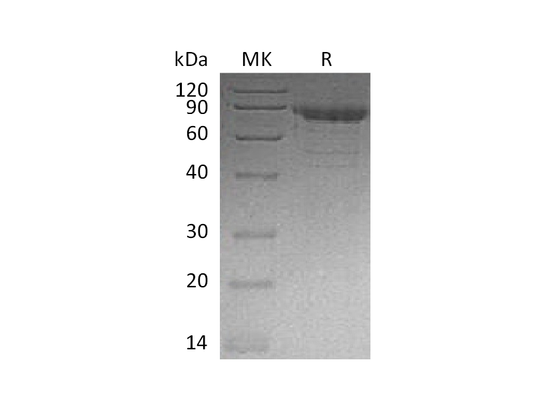 Recombinant Human CDH11 (C-6His)