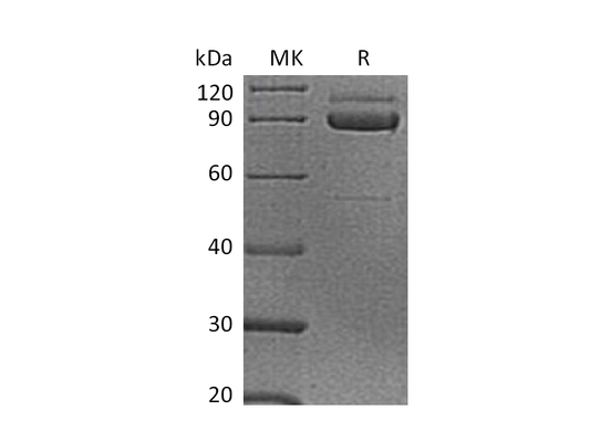 Recombinant Human CDH3 (C-6His)