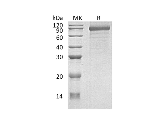 Recombinant Human CDH8 (C-6His)