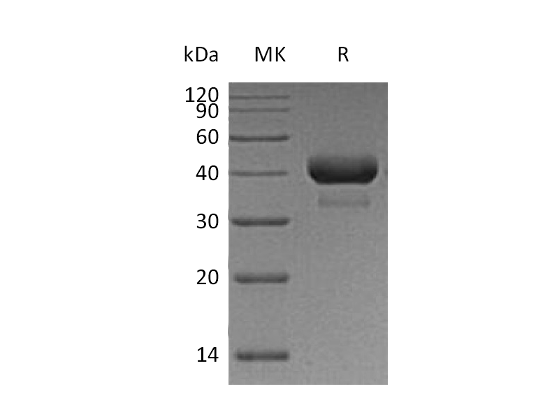 Recombinant Human CTSB (C-6His)