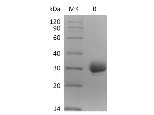 Recombinant Human CCDC134 (C-6His)