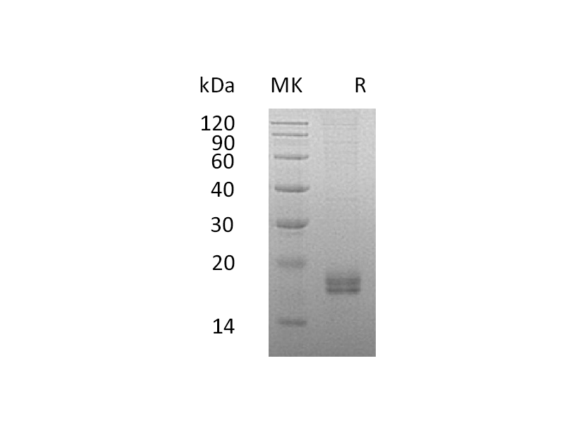 Recombinant Human CCL24 (C-6His)