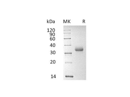 Recombinant Human CD2 (C-6His)