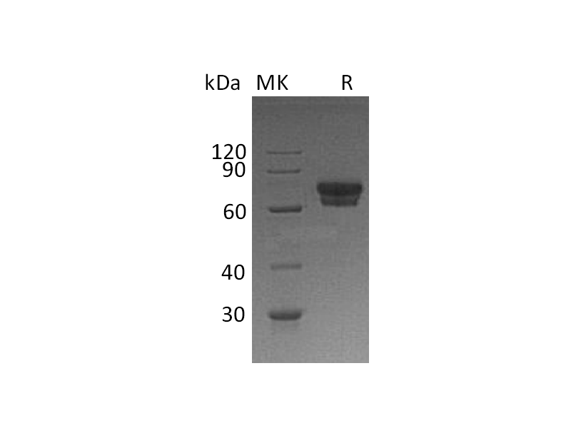 Recombinant Human IL-2RA (C-Fc)
