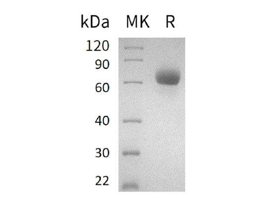 Recombinant Human LMIR2 (C-Fc)