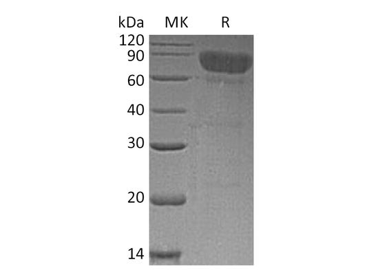 Recombinant Human TCblR (C-Fc)