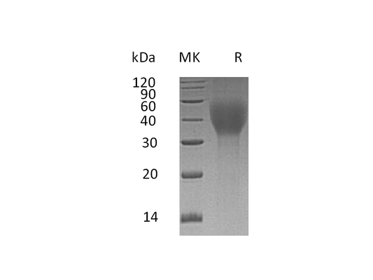 Recombinant Human TCblR (C-6His)