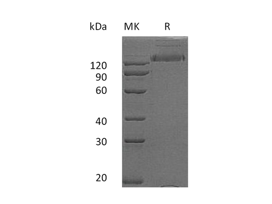 Recombinant Human HER2 (C-Fc)