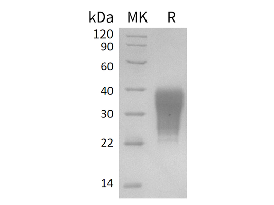Recombinant Human FAS (C-6His)